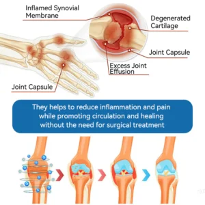 Flysmus® BPC-157 Joint Healing Cream