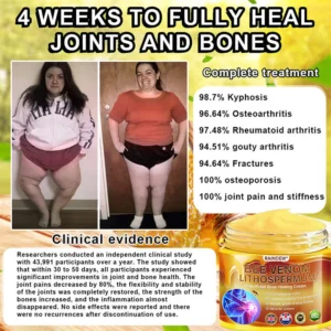 BEE VENOM LITHOSPERMUM Pain-Relief Bone Healing Cream