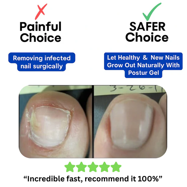 Maanufo Fungal Nail Renewal Patches