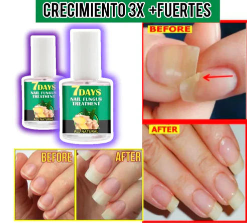Extra-strength nail repair solution