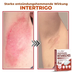 Oveallgo® MicroNeedle PLUS Botanical Day Clear Patch