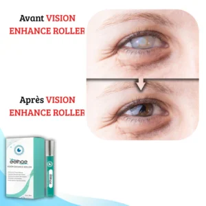 VISION ENHANCE ROLLER: Clarity - Give Your Eyes New Vitality