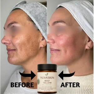 YuvaSkin™ Beef Tallow Cream