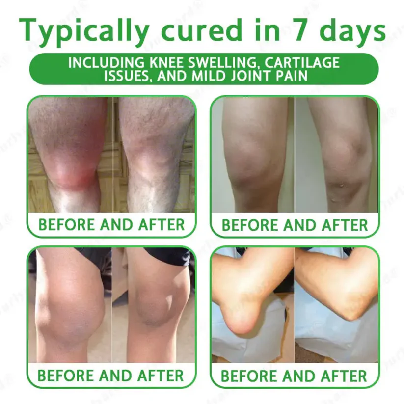 NovaRX® Advanced Magnesium & Emu Oil Massage Pain Relief Cream