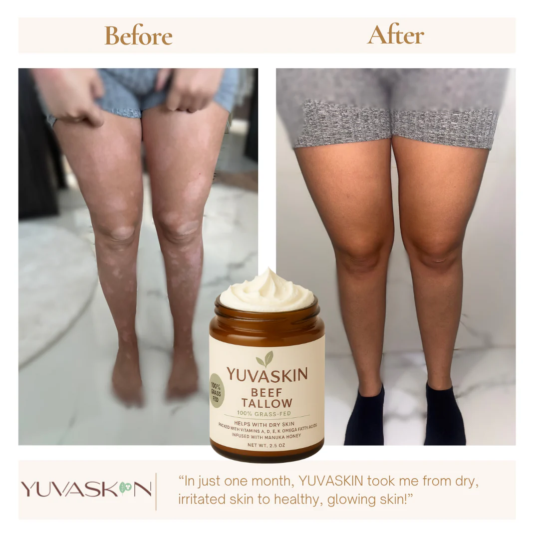 YuvaSkin™ Beef Tallow Cream