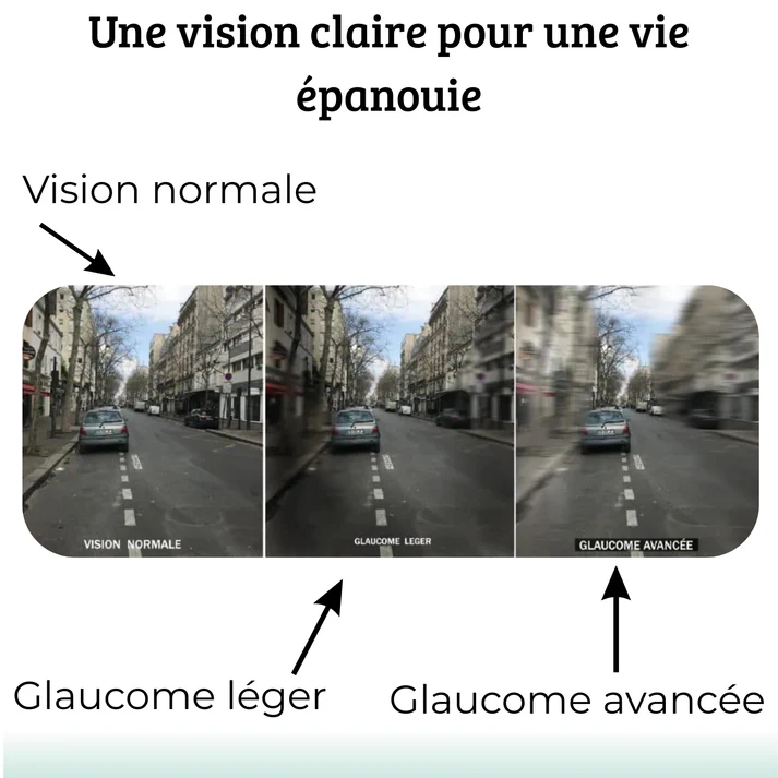 VISION ENHANCE ROLLER: Clarity - Give Your Eyes New Vitality