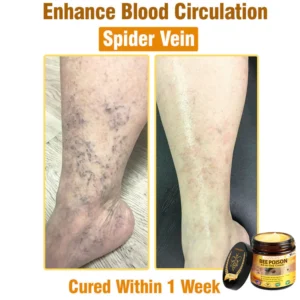 LOVILDS™ Bee Poison All-in-One Cream US Dermatologist Approved