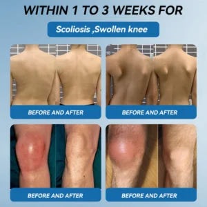 Flysmus® BPC-157 Joint Healing Cream