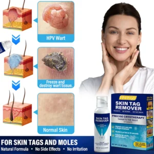 Fivfivgo® TagRecede Cryo Treatment Spray