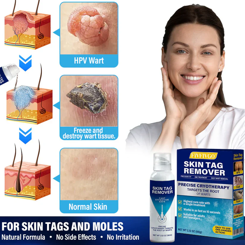 Fivfivgo® TagRecede Cryo Treatment Spray