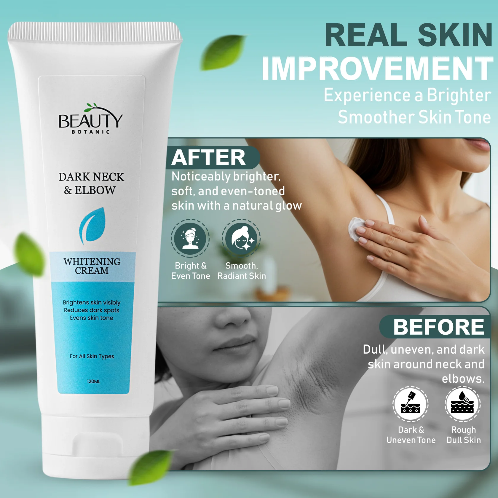 Dark Neck & Elbow Whitening Cream