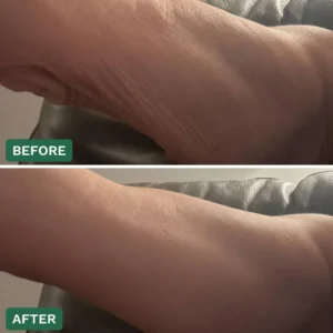 Crepey Skin Repair Cream