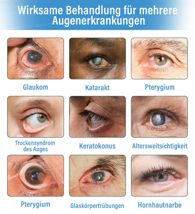 Ourlyard® Supramolecular Eye Drops