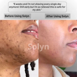 Solyn™ Cyperus Rotundus Skin Serum