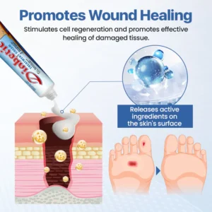 Diabetes Wound professional Treatment Cream