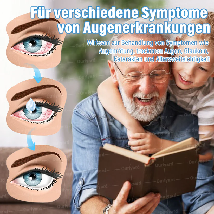 Ourlyard® Supramolecular Eye Drops - Image 4