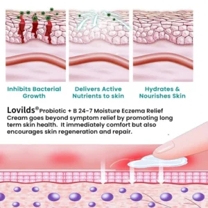 Lovilds® Probiotic + B 24-7 Moisture Eczema Relief Cream