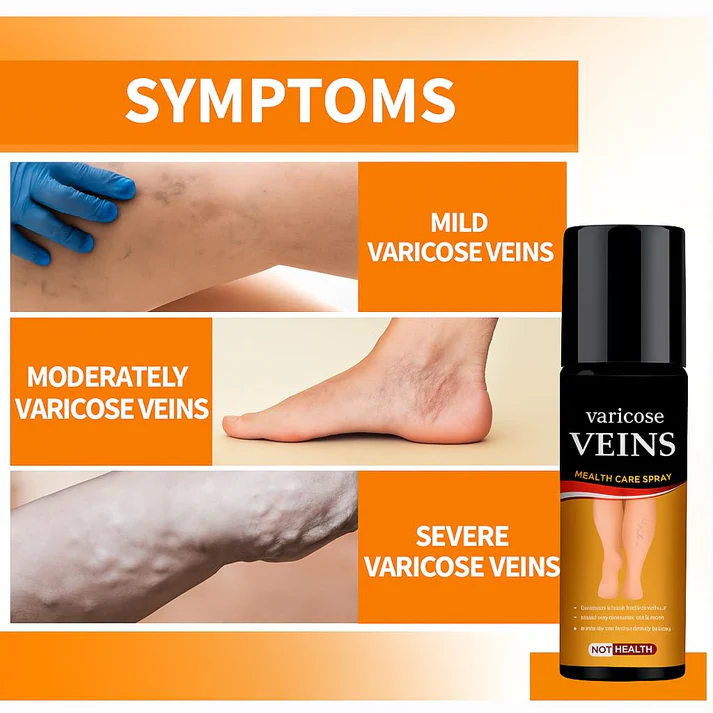 Turmeric Varicose Veins Relief Spray