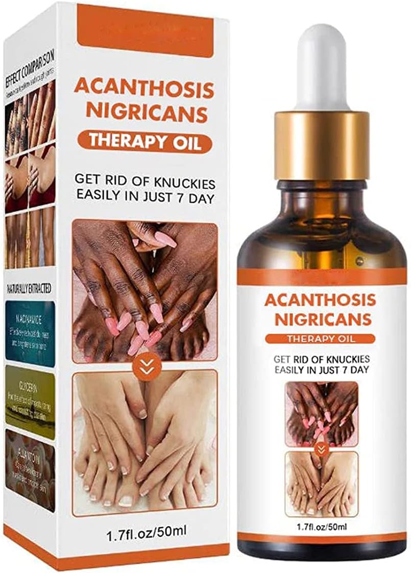 Oveallgo™ Therapy Oil for Acanthosis Nigricans