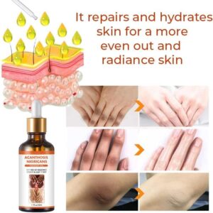 Oveallgo™ Therapy Oil for Acanthosis Nigricans