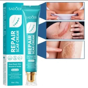 REPAIR Scar, Burn & Stretch Mark Healing Cream