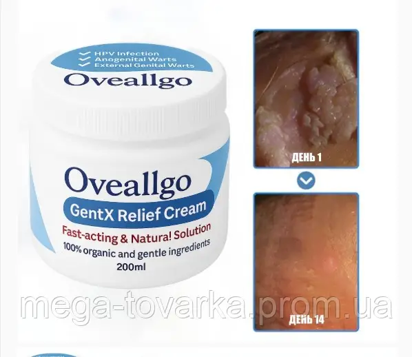 Oveallgo GentX Relief Natural cream HPV, warts, and eczema
