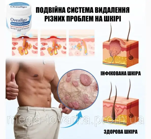 Oveallgo GentX Relief Natural cream HPV, warts, and eczema