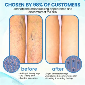 Ourlyard® VascuCare Vein Healing Spray