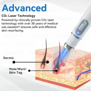 𝐉𝐚𝐬𝐬𝐞𝐞𝐦® 𝐍𝐨𝐧-𝐈𝐧𝐯𝐚𝐬𝐢𝐯𝐞 𝐌𝐨𝐥𝐞 & 𝐖𝐚𝐫𝐭 𝐋𝐚𝐬𝐞𝐫 𝐑𝐞𝐦𝐨𝐯𝐚𝐥 𝐏𝐞𝐧