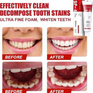 SP-4 Probiotic Whitening Toothpaste, Teeth Whitening