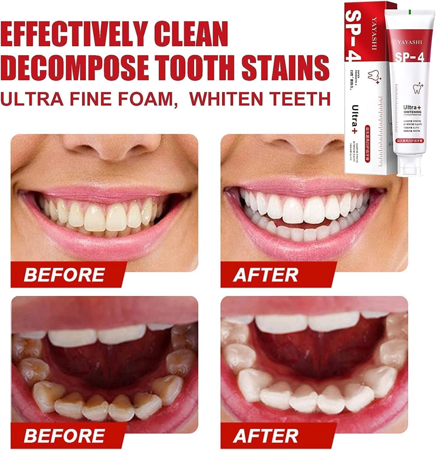 SP-4 Probiotic Whitening Toothpaste, Teeth Whitening
