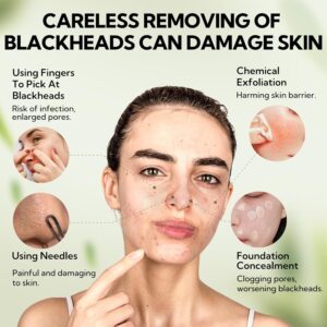 LANBENA BAMBOO & CHARCOAL BLACKHEADS REMOVER