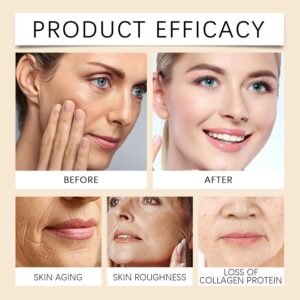 Anti-Wrinkle™ | Botox Wrinkle Removal Cream