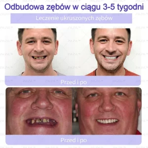 ZVL™ Mineral Tooth Repair Powder
