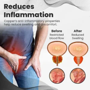 Ringmiz Copper Mag Prostate Therapy Ring