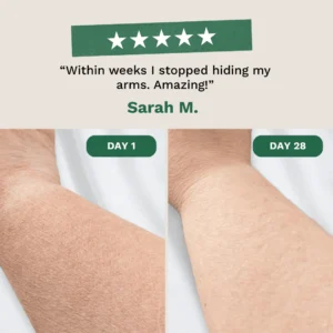 Crepey Skin Repair Cream