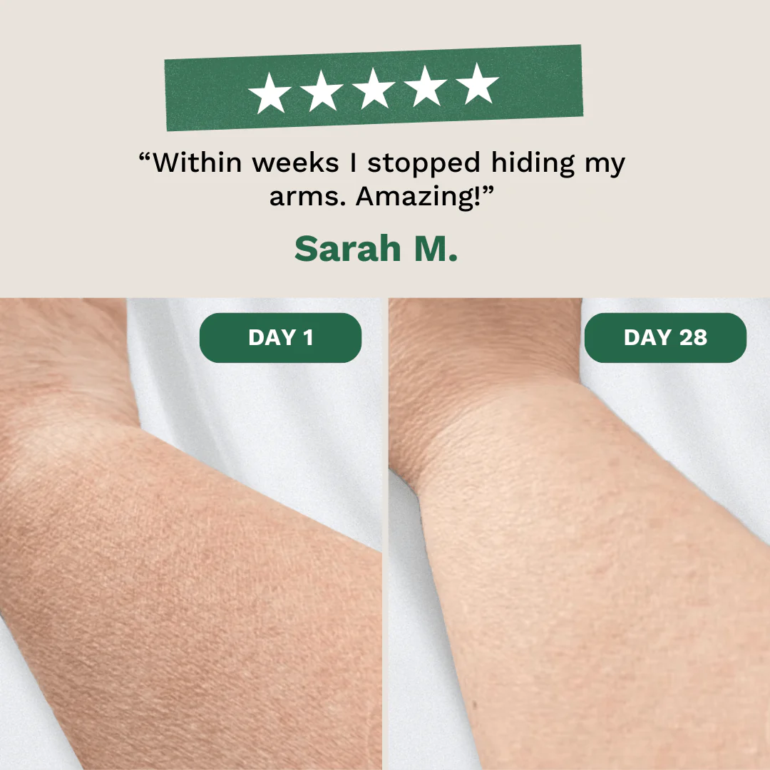 Crepey Skin Repair Cream