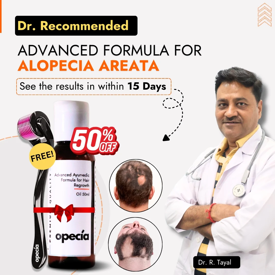 Advanced Formula For Alopecia Treatment