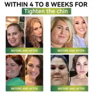 Buildleaf® Support Gummies