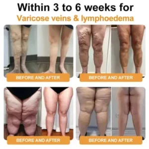 CZTICLE® Ultrasound Fat Reduction & Far Infrared Blood Sugar Balance