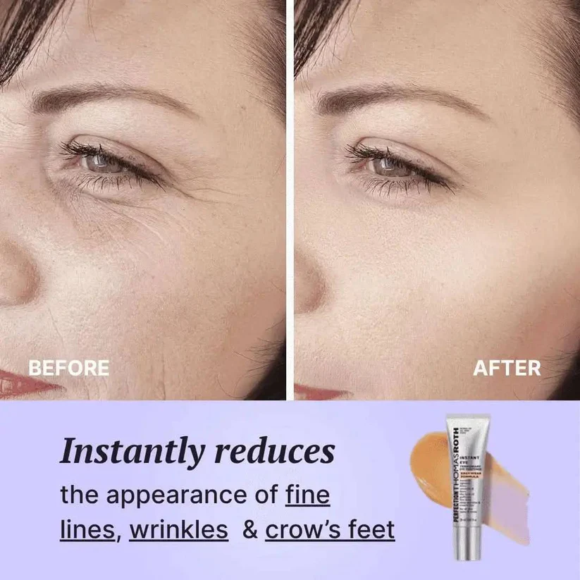 Perfect FirmX - Instant Eye Tightener