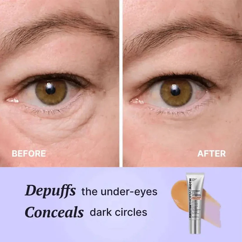 Perfect FirmX - Instant Eye Tightener