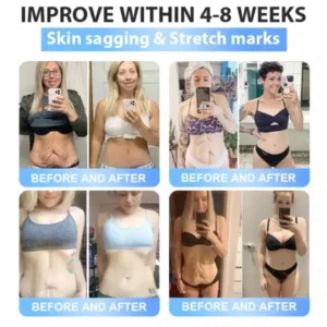 Slimming Patch with Collagen + Matrixyl 3000