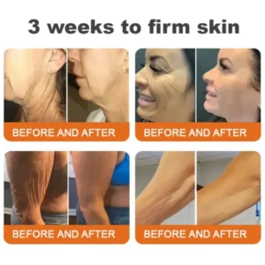 Firming gel for sagging skin