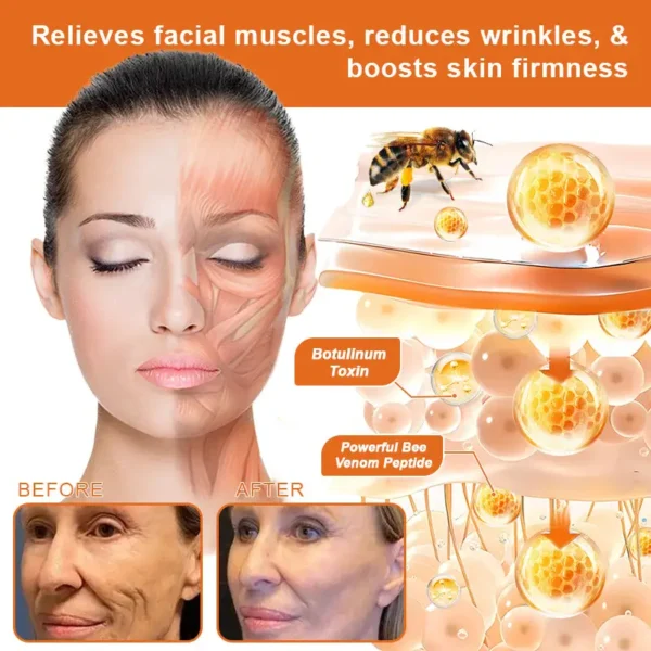 Firming gel for sagging skin "BEE Venom Flysmus™
