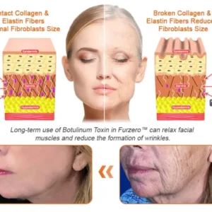 Firming gel for sagging skin