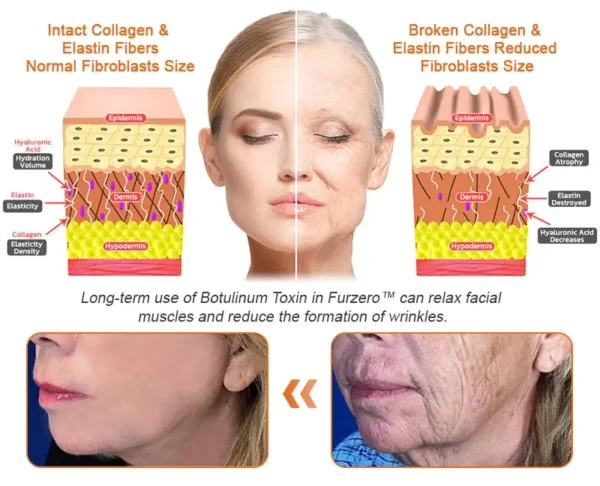 Firming gel for sagging skin "BEE Venom Flysmus™