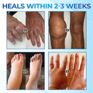 Seurico™ Magnesium Pain & Bone Healing Cream