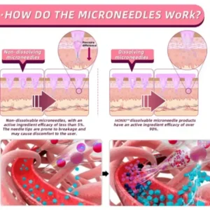 HonXi® Semaglutide Nano Microneedle Slimming Patch
