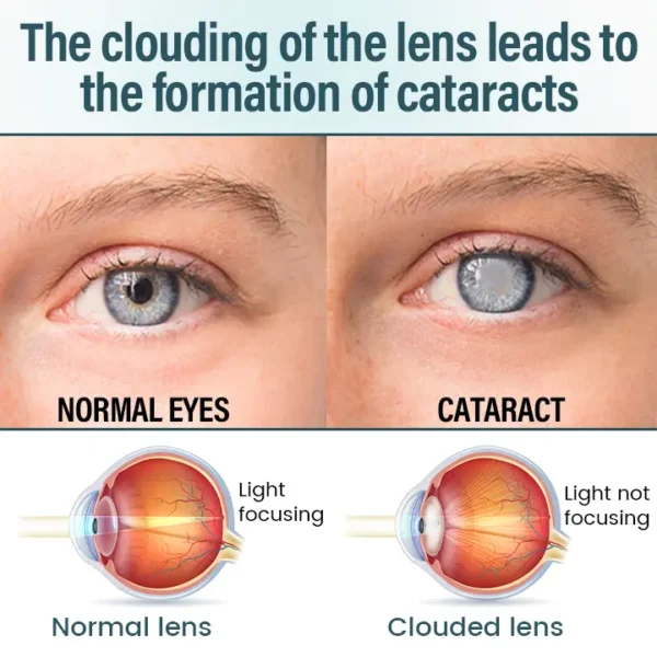 LOVILDS™ OptiFusion Nano Eye Drops Serum